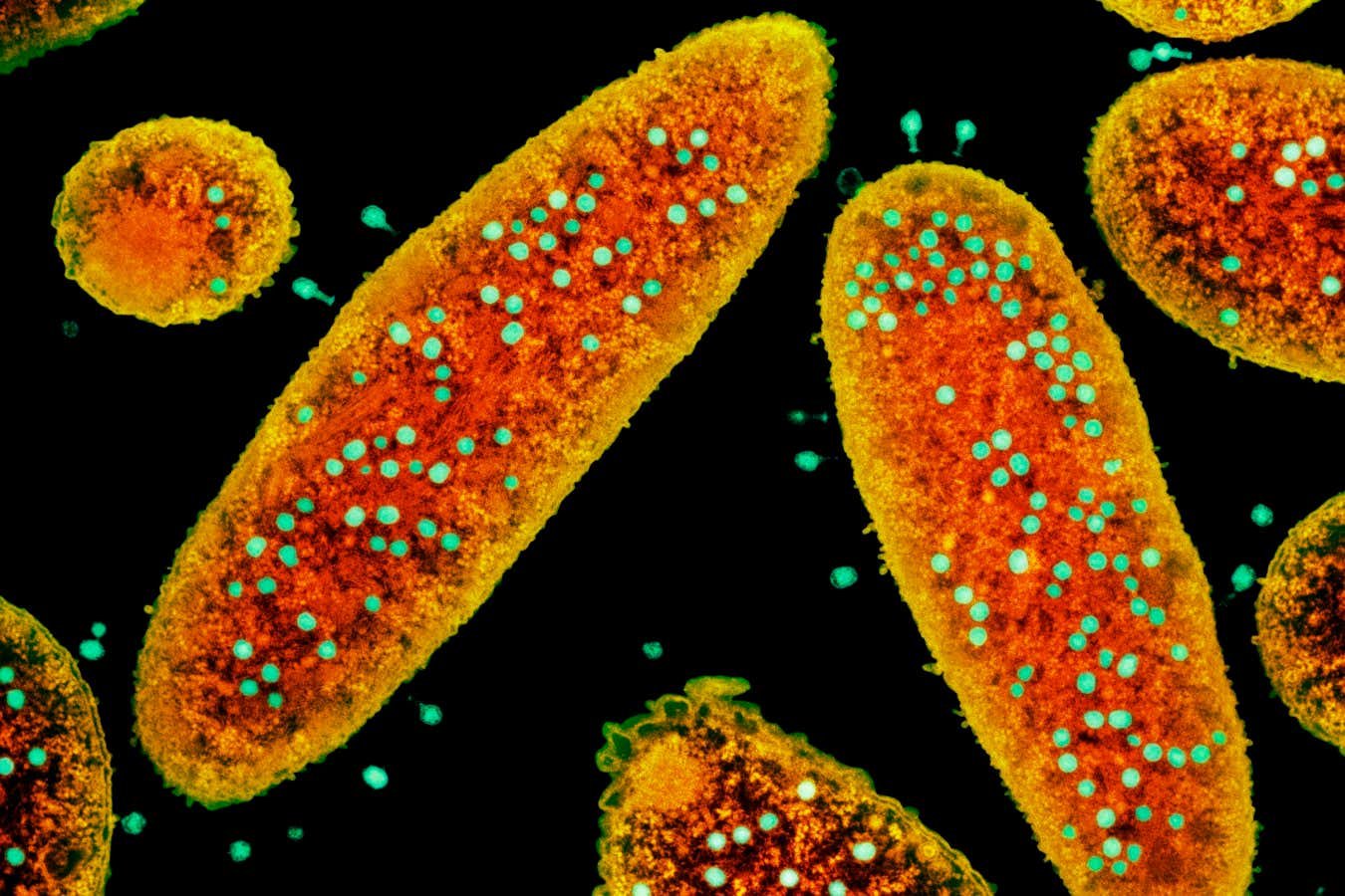 Fagos podem redirecionar imunidade de vacinas para combater células cancerígenas