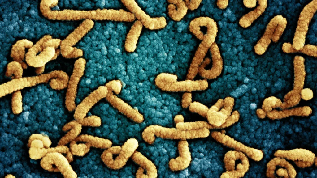 Marburg outbreak is reported in Uganda, threatening to complicate Ebola response in region