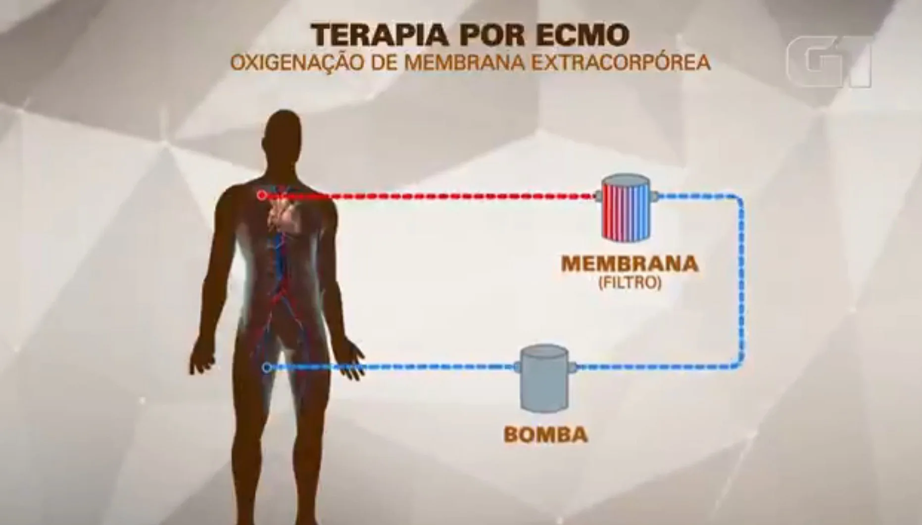 MC Marcinho é submetido a terapia ECMO após parada cardiorrespiratória