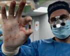 Documentário retrata a luta de cirurgião em Gaza durante conflitos