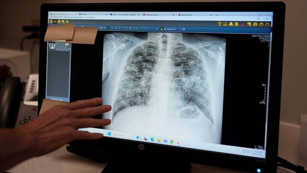 FDA concede designação de avanço para IA generativa na radiologia