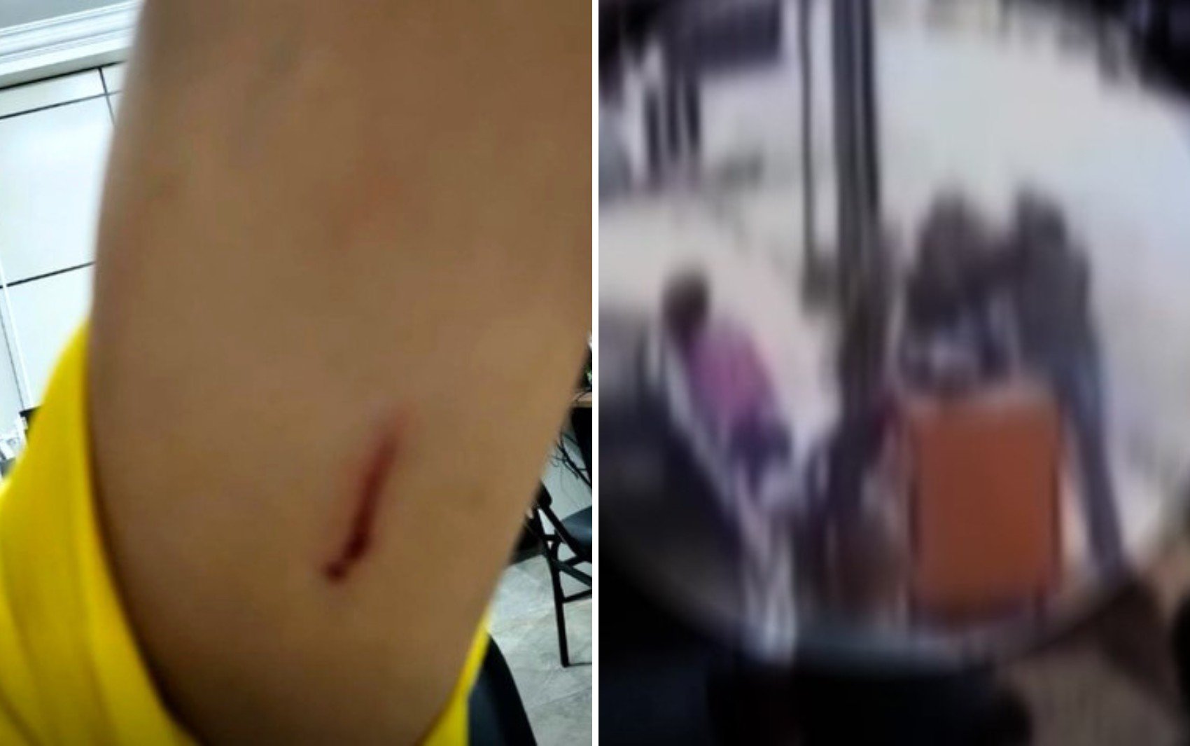 Funcionária é agredida com tesoura após denunciar colega por uso de celular em trabalho