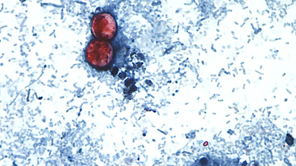 Casos de infecção por cyclospora atingem recorde nos EUA, com Michigan investigando alface como possível causa