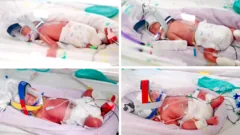 Rare identical quadruplets born in Australia