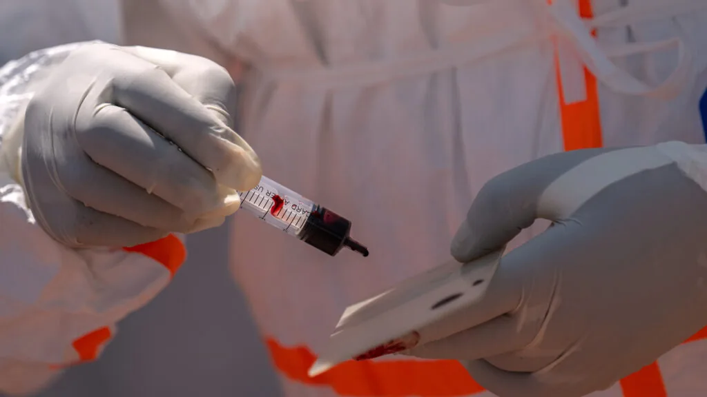 Opinion: What Ebola and Marburg are teaching us about the next pandemic