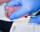 Todos os recém-nascidos na Inglaterra serão testados para atrofia muscular espinhal a partir de 2027