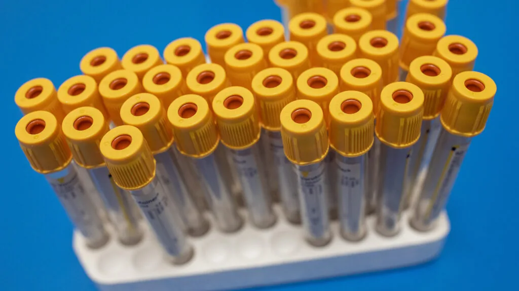 Uso excessivo de testes diagnósticos pode ser combatido com gestão adequada