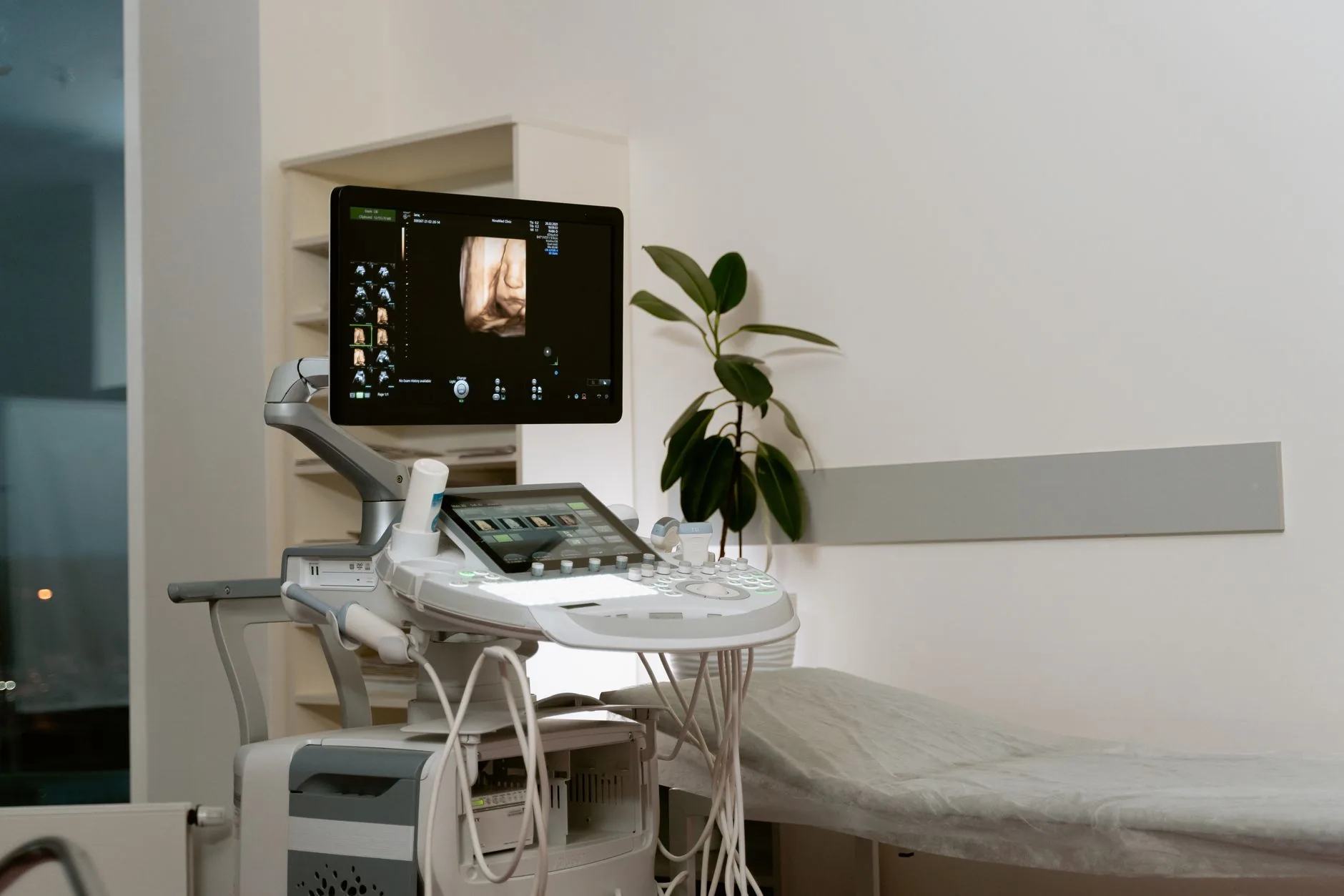 Midjourney divulga detalhes de seu escâner médico, mas falta comprovação de eficácia