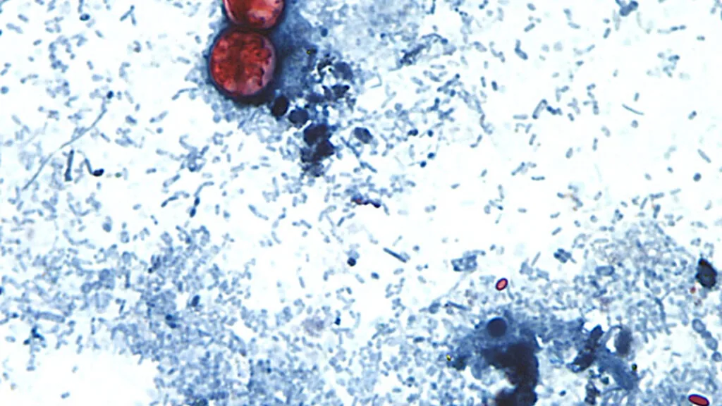A new, separate outbreak of the diarrhea-causing parasite