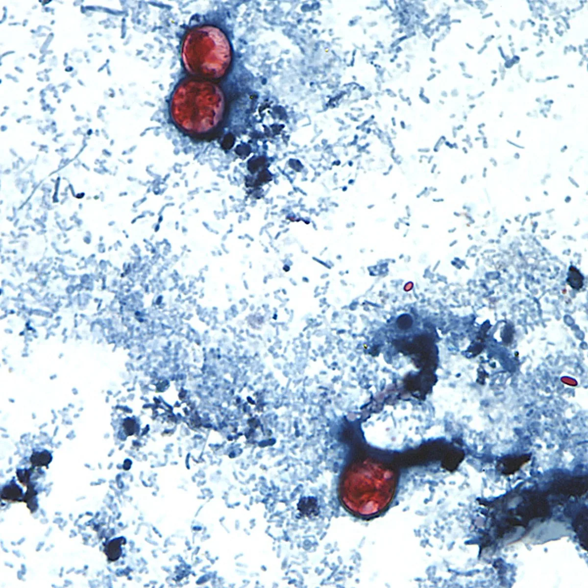 Ciclosporíase infecta mais de 2,8 mil nos EUA; alface é suspeita