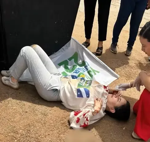 Candidata a deputada Maria Yvelonia tem quadro estável após queda de trio elétrico