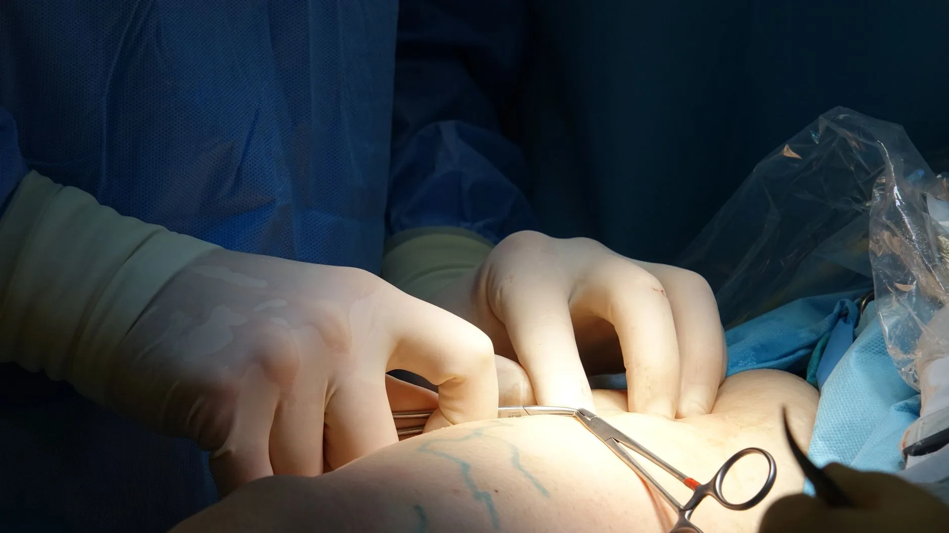 Papa Leo XIV vai submeter-se a cirurgia para remover nódulo pulmonar