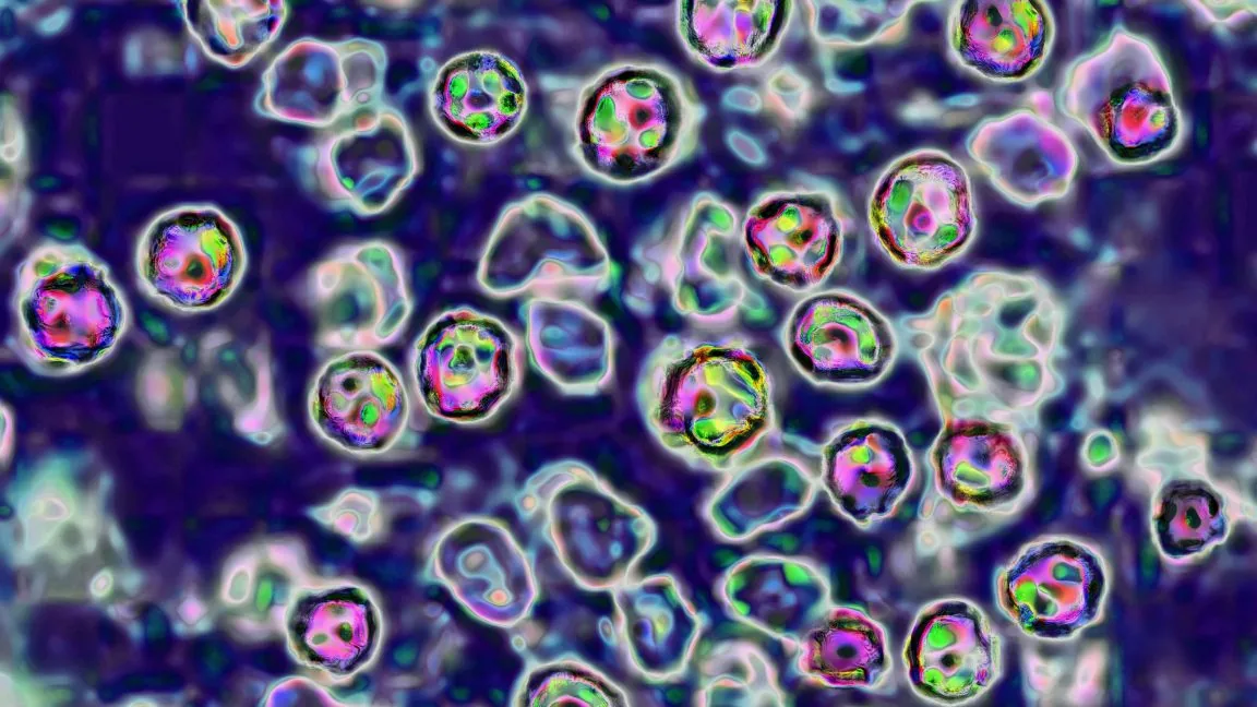 Measles Outbreak in South Carolina Spread to Washington State
