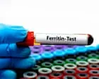 Ferritin face: são as redes sociais corretas sobre deficiência de ferro?