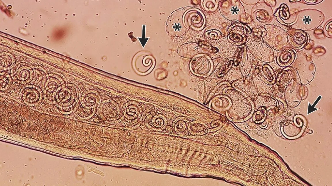 Medicina extrai 11 vermes vivos dos olhos de agricultor sul-coreano